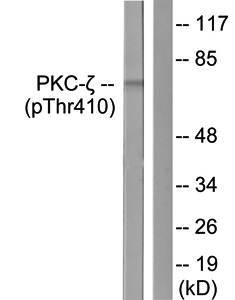 PKC ζ (Phospho-Thr410) Antibody