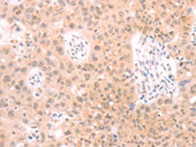 PKD2L1 Antibody