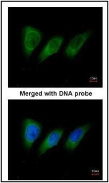 protein kinase N2 Antibody