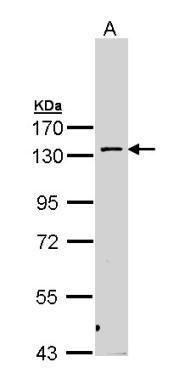 protein kinase N2 Antibody