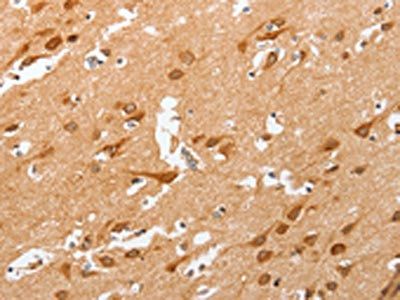 PLA2G4A Antibody