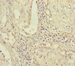 PLAA Antibody