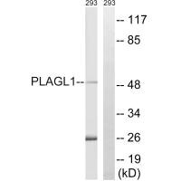 PLAGL1 Antibody