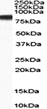 Plakoglobin/Gamma-catenin Antibody