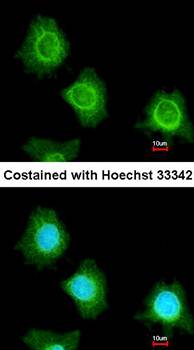platelet factor 4 variant 1 antibody