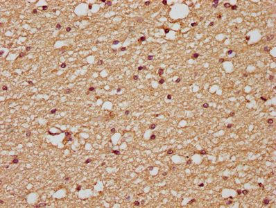 PLAUR Antibody