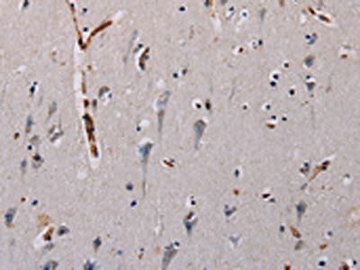 PLCB3 Antibody