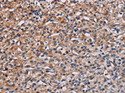 PLCB3 Antibody