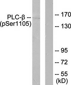 PLCB3 (Phospho-Ser1105) Antibody