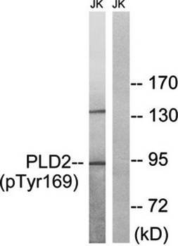 PLD2 (Phospho-Tyr169) Antibody