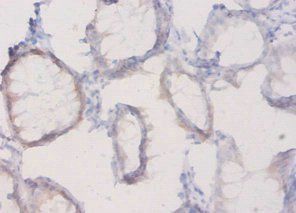 PLXNA1 Antibody