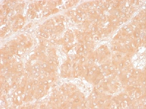 PLIN2 Antibody
