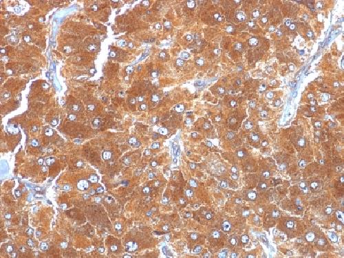 PLIN2 Antibody