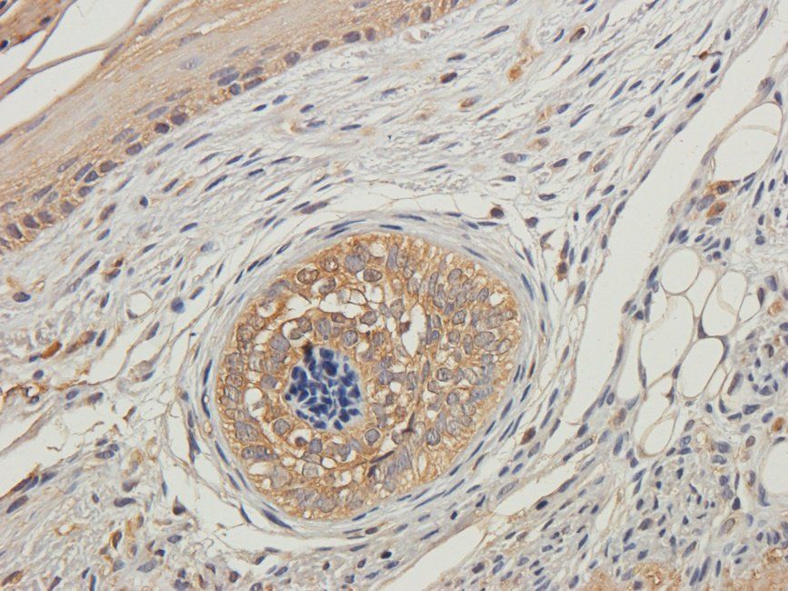 PLK1 Rabbit Polyclonal Antibody