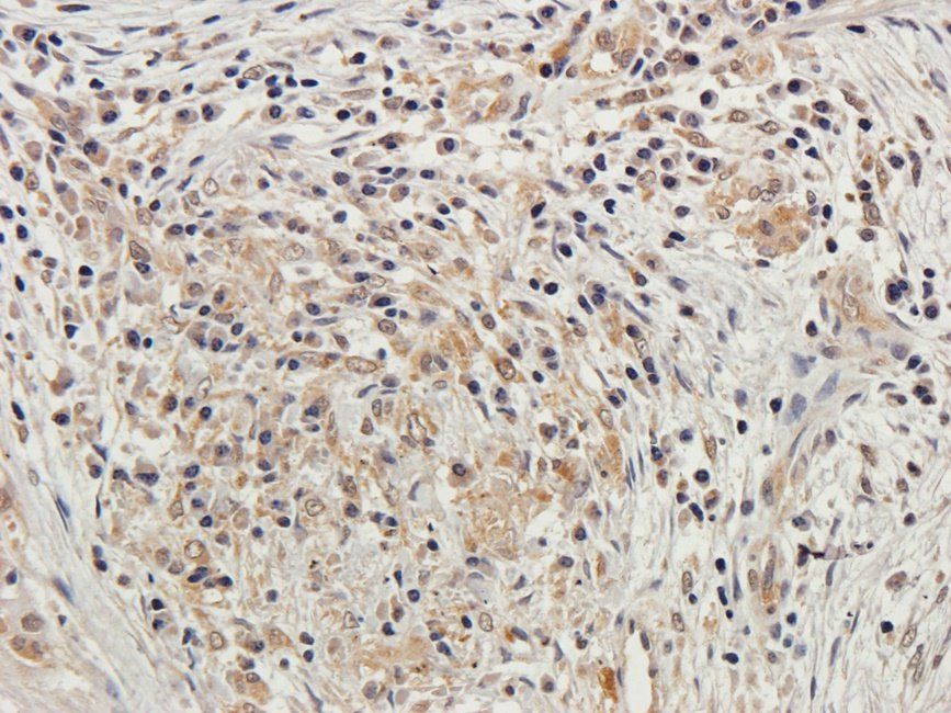 PLK1 Rabbit Polyclonal Antibody