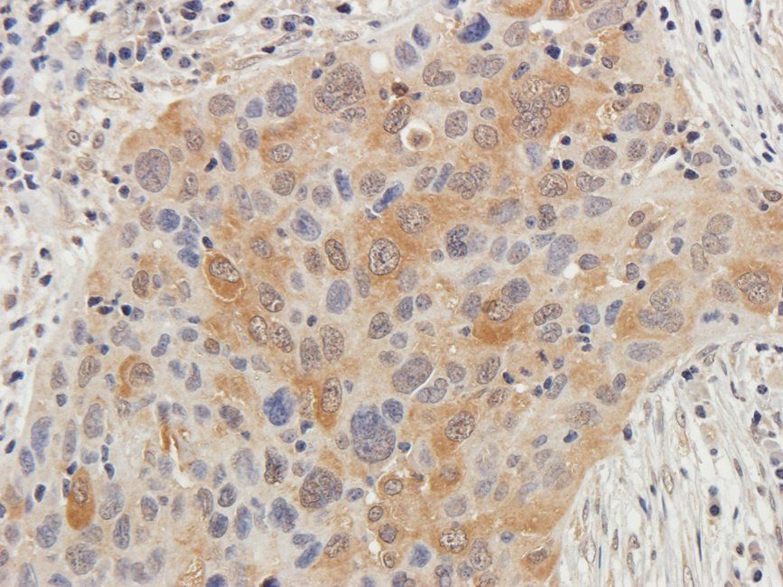 PLK1 Rabbit Polyclonal Antibody