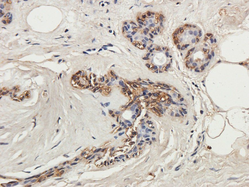 PLK1 Rabbit Polyclonal Antibody