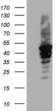 PLK4 Antibody