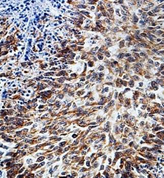 PMM2 Rabbit Polyclonal Antibody