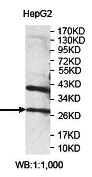 PMM2 Rabbit Polyclonal Antibody