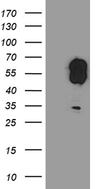 PMP22 Antibody