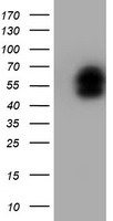 PMVK Antibody