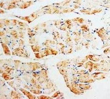 Phosphomevalonate kinase PMVK Rabbit Polyclonal Antibody