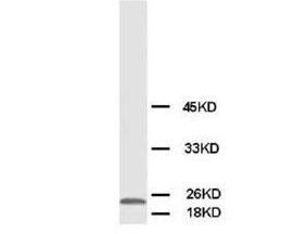 Phosphomevalonate kinase PMVK Rabbit Polyclonal Antibody