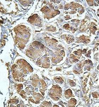 PNLIP Rabbit Polyclonal Antibody