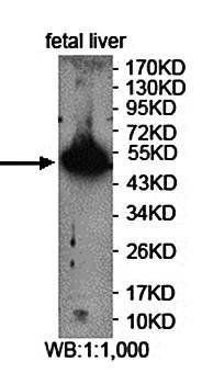 PNLIP Rabbit Polyclonal Antibody