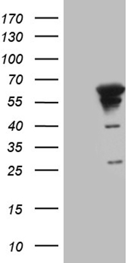 KCTD13 Antibody