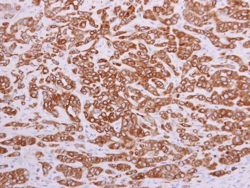 paraoxonase 2 Antibody