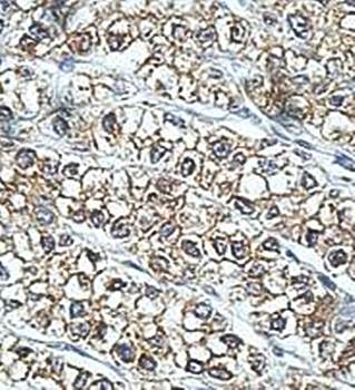 PON2 Rabbit Polyclonal Antibody