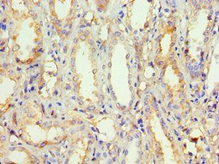 POSTN Antibody