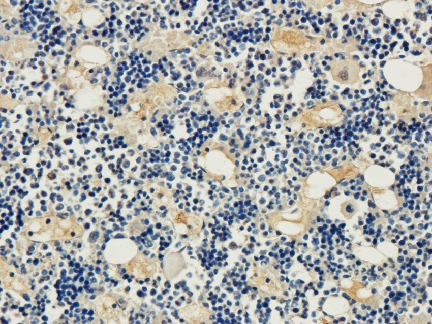POSTN Rabbit Polyclonal Antibody