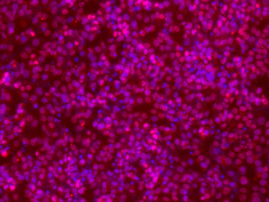 POU2F1 Antibody