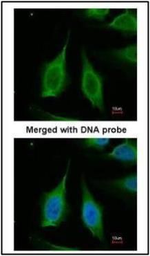 pyrophosphatase (inorganic) 1 Antibody