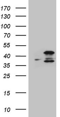 PPA2 Antibody