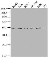 PPARA Antibody