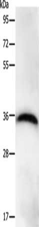 PPP1CB Antibody