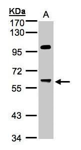 protein phosphatase 1 regulatory subunit 16A Antibody