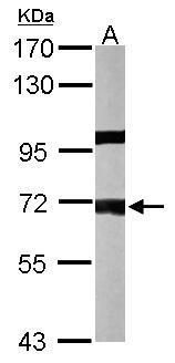 protein phosphatase 1 regulatory subunit 16A Antibody