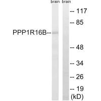PPP1R16B Antibody