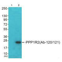 PPP1R2 Antibody