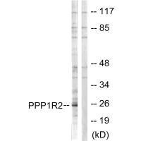 PPP1R2 Antibody