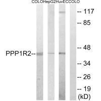 PPP1R2 Antibody