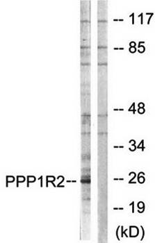 PPP1R2 (Ab-120/121) Antibody