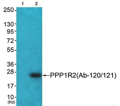 PPP1R2 (Ab-120/121) Antibody
