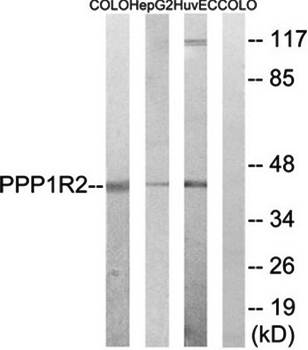 PPP1R2 (Ab-44) Antibody