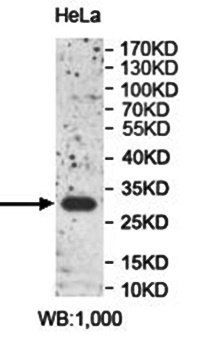 PPP1R3B Antibody